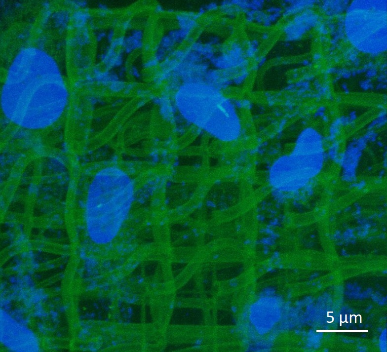 Cell culture in a collagen microscaffold - Courtesy of O. Stephan et al.